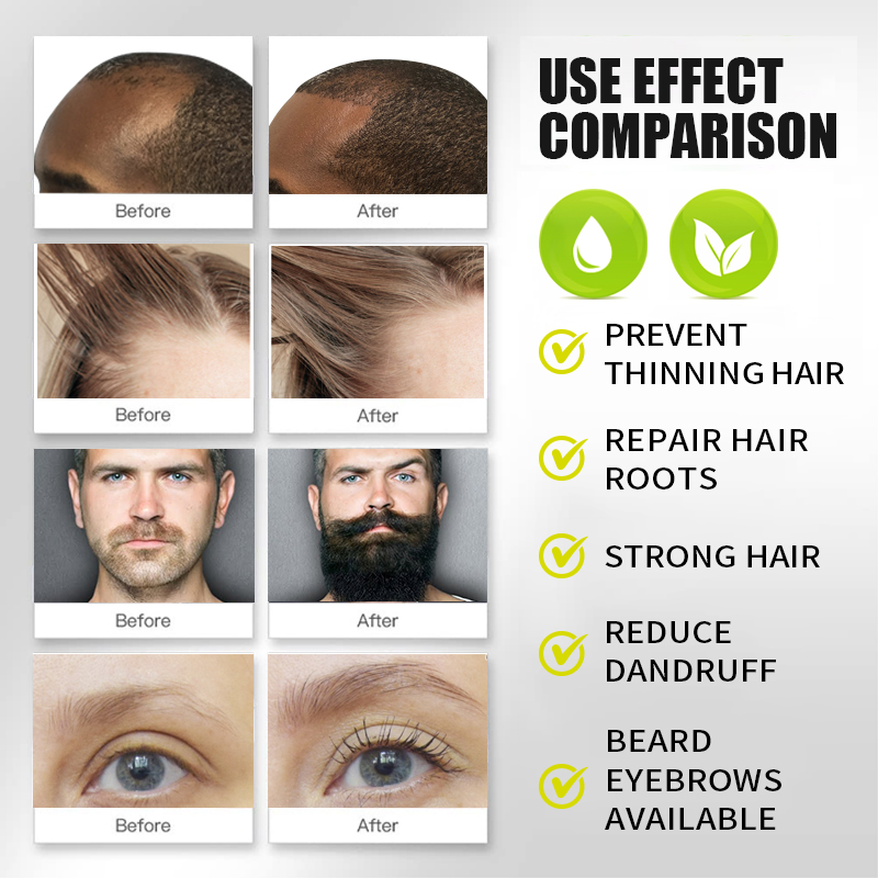PURC Biotin Fast Hair Growth O - Hair Care Vitamin E recension och pris