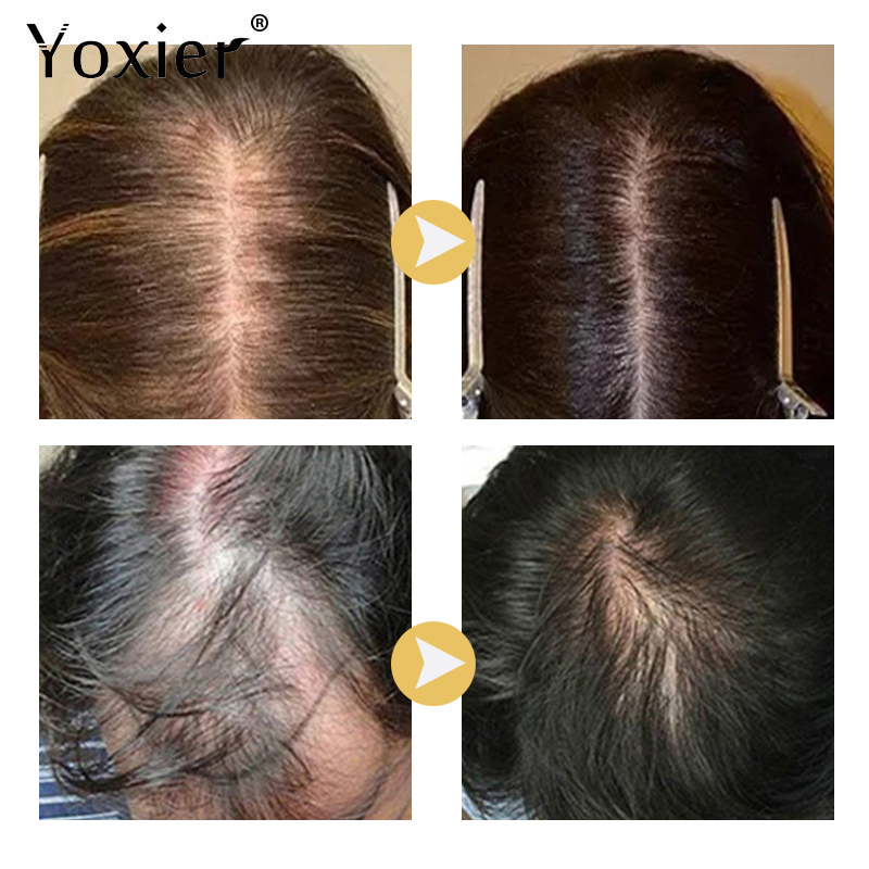 Intensive Growth Serum Prevent - Hair Care Hair Serum recension och pris