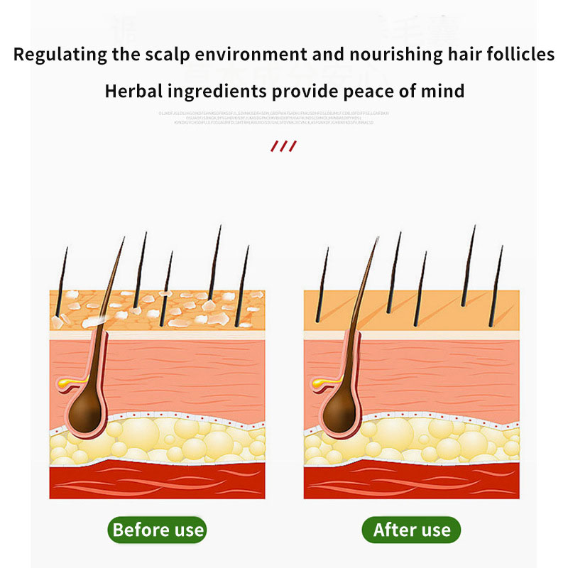 Sophora Flavescens Hair Follic - Hair Care Cream recension och pris